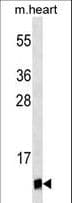 Monoclonal Mouse anti-Human UBL5 Antibody (WB)