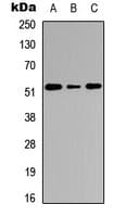 CTSC / Cathepsin C / JP Antibody (Internal)