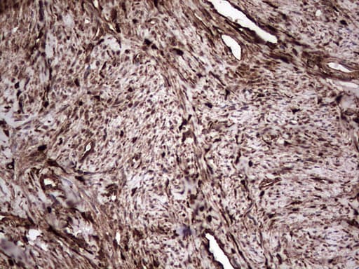 LGALS3 / Galectin 3 Antibody (clone OTI6E1)