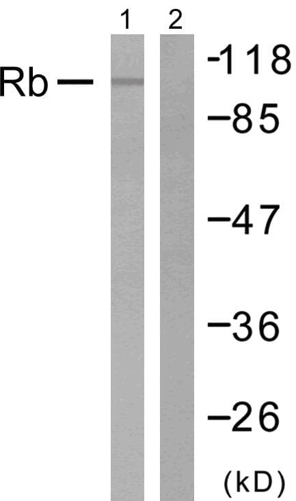 Polyclonal Rabbit anti-Human RB1 / Retinoblastoma / RB Antibody (p807, IHC, WB)