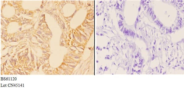 Polyclonal Rabbit anti-Human ABHD4 Antibody (IHC, WB)