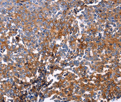 DUSP6 / MKP3 Antibody