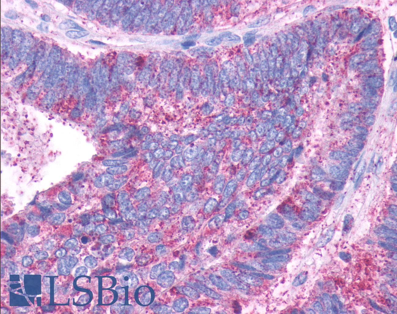PathPlus™ DRD1 / Dopamine Receptor D1 Antibody (C-Terminus)