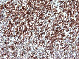 CHAF1B / CAF1 Antibody (clone OTI4F7)