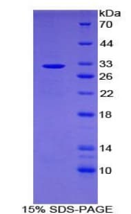 Human LRIG1 Protein (Recombinant His-T7)