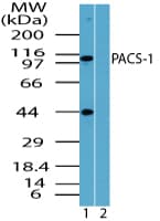 Polyclonal Rabbit anti-Human PACS1 Antibody (aa300-350, WB)