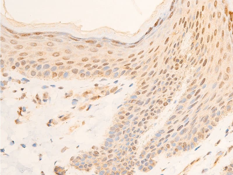 Polyclonal Rabbit anti-Human NFKBIA / IKB Alpha / IKBA Antibody (phospho-Ser32,phospho-Ser36, IHC, IF, WB)