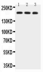 BRCA1 Antibody (aa1661-1863)
