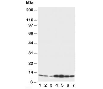 S100B / S100 Beta Antibody (aa64-78)