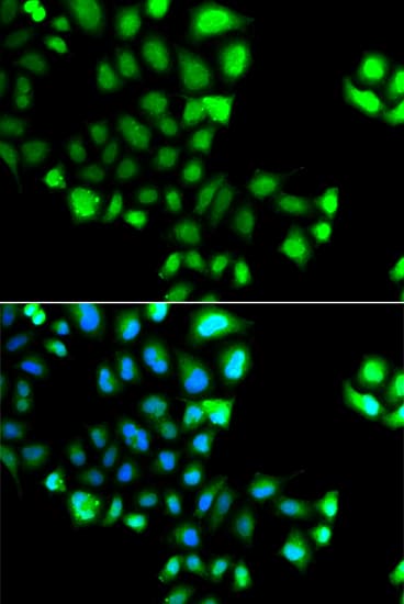 SUMO4 Antibody