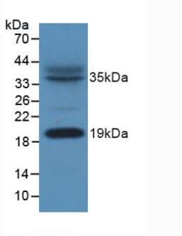 NDUFAB1 / ACP Antibody (aa5-129)