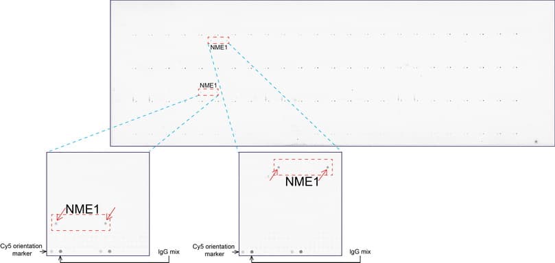 NME1 / NM23 Antibody (clone UMAB93, Carrier-free)