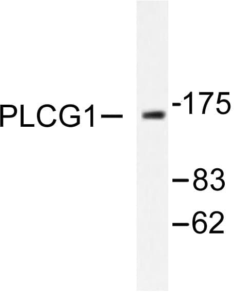 Polyclonal Rabbit anti-Human PLCG1 Antibody (Gly777, IHC, WB)