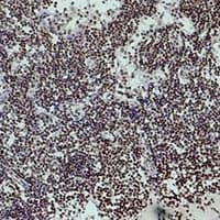 Monoclonal Mouse anti-Human HIST1H3H Antibody (IHC, WB)