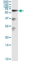 Monoclonal Mouse anti-Human HABP2 Antibody (clone 1H4)