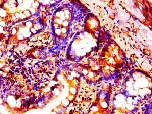 HIST1H1B Antibody