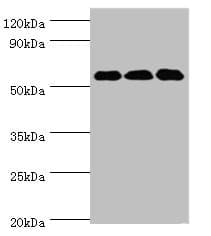 Polyclonal Rabbit anti-Human XIAP Antibody (aa1-200, IHC, WB)