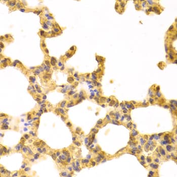 IHC-plus™ UBE2I / UBC9 Antibody
