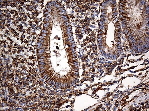 SPTAN1 / Alpha Fodrin Antibody (aa1-147, clone OTI9C10)