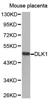 Polyclonal Rabbit anti-Human DLK1 / Pref-1 Antibody (IHC, WB)