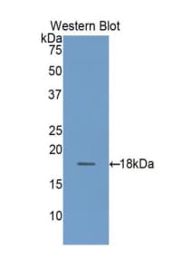 TSPAN3 Antibody (aa1385-1525, FITC)