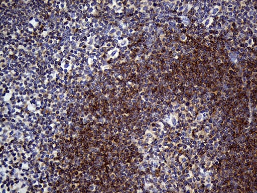 Monoclonal Mouse anti-Human SMAP2 Antibody (clone OTI6E11, Carrier-free, IHC, WB)