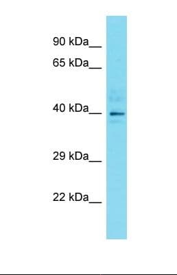 Polyclonal Rabbit anti-Human DYNC2LI1 / D2LIC Antibody (C-Terminus, WB)