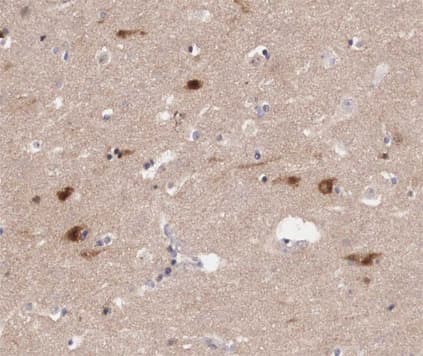 JUNB / JUN-B Antibody (phospho-Ser259)