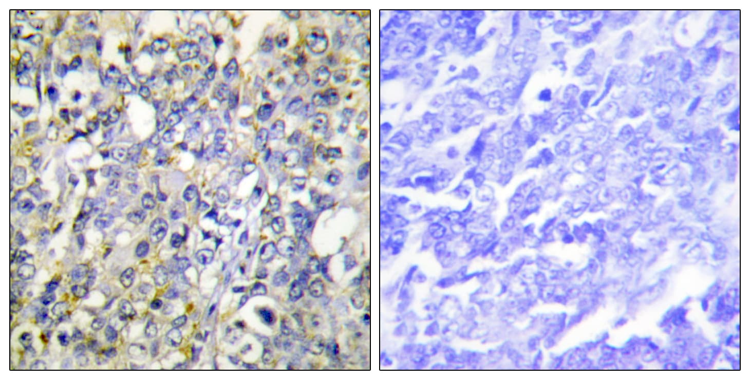 IGFBP3 Antibody (aa151-200)