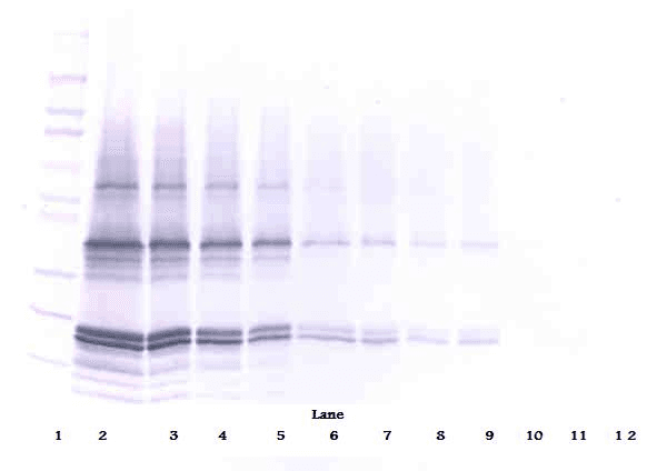 p16INK4a / CDKN2A Antibody