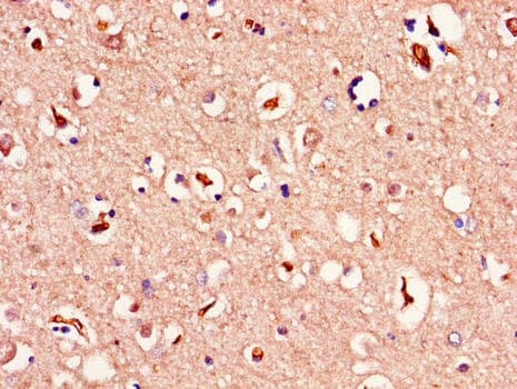 MAPK10 / JNK3 Antibody
