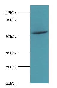 NR1A2 / THRB Antibody (aa1-461)