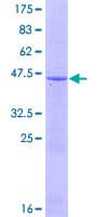 Human IFNA17 / Interferon Alpha 17 Protein (Recombinant GST)