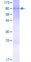 Human OTUD4 Protein (Recombinant GST)