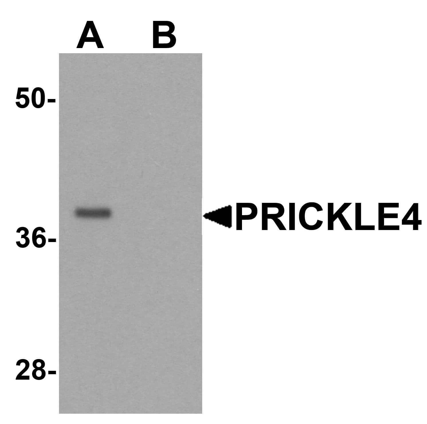IHC-plus™ PRICKLE4 Antibody