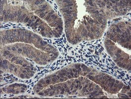 RPN1 / Ribophorin I Antibody (clone OTI5B1, Carrier-free)