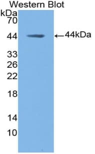 MUC5B Antibody (aa3667-3771)