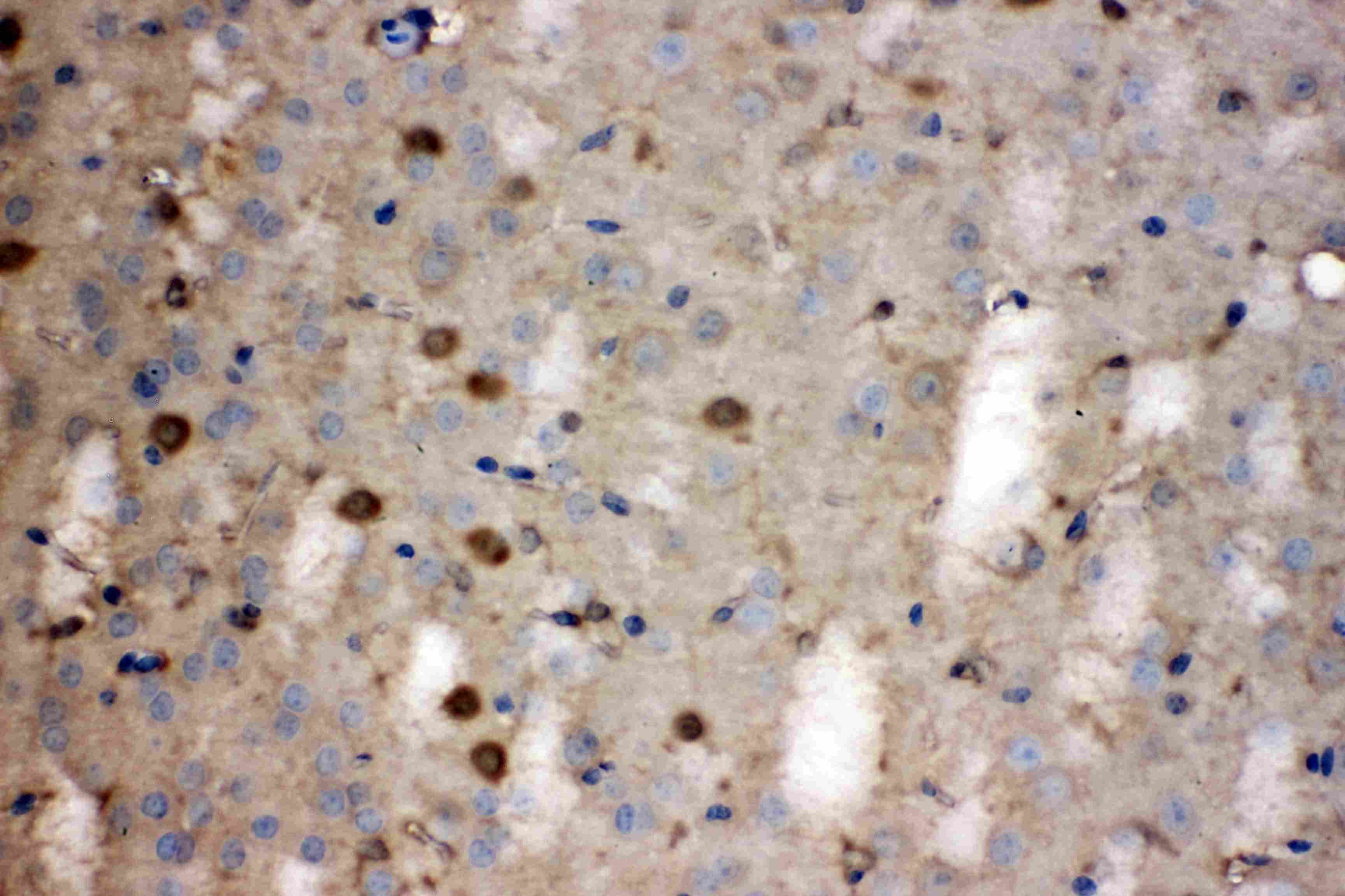 LDHB / Lactate Dehydrogenase B Antibody