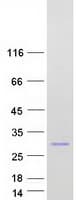 Human CBX1 / HP1 Beta Protein (Recombinant Myc-DDK (Flag))