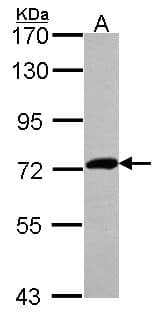 IHC-plus™ Polyclonal Rabbit anti-Human XPNPEP2 Antibody (aa286-564, IHC, WB)