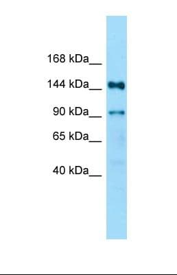 Polyclonal Rabbit anti-Human RPAP1 Antibody (aa191-240, WB)