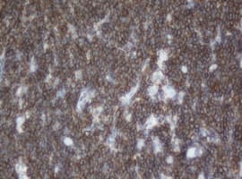 Monoclonal Mouse anti-Human CD20 Antibody (clone OTI2C11, IHC, WB)