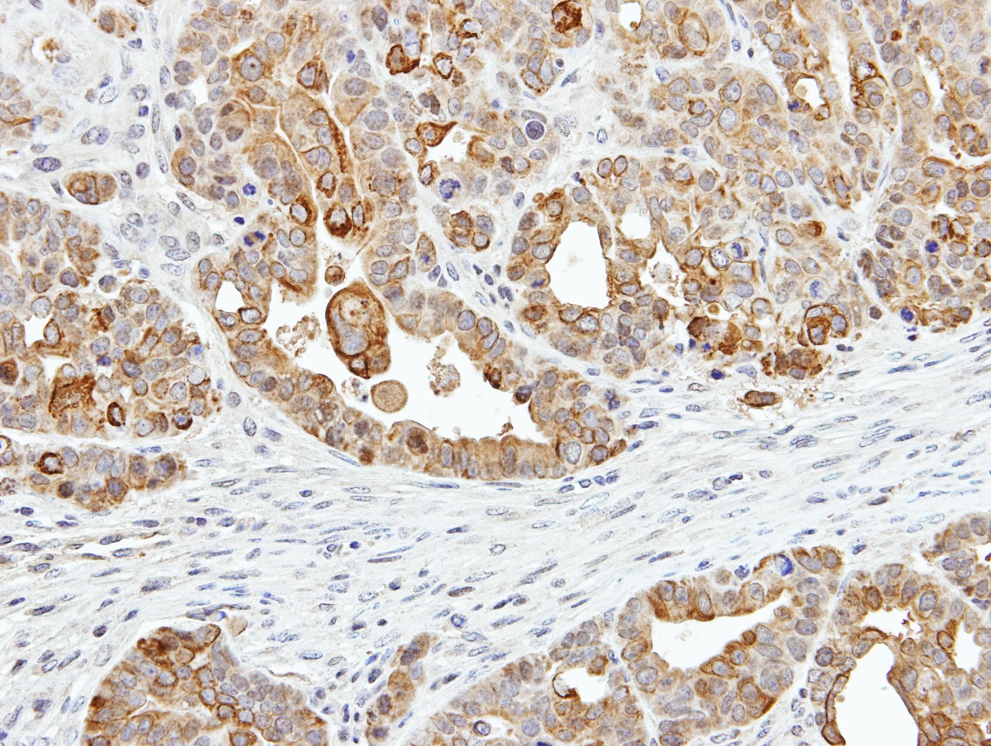 ZER1 Antibody (aa537-766)