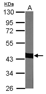 IHC-plus™ ACTC1 / Alpha Cardiac Actin Antibody (aa99-354)