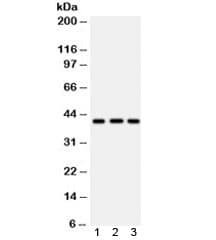 HLA-A Antibody
