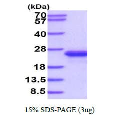 Mouse IL-33 Protein (Recombinant His)