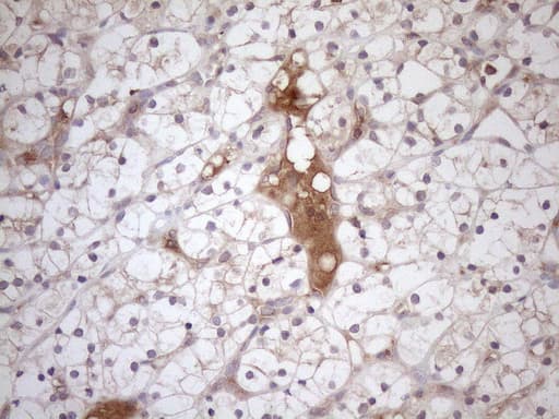 TNFRSF10B / Killer / DR5 Antibody (aa203-411, clone OTI2A5)