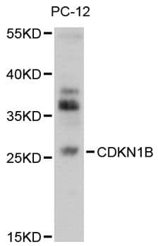 CDKN1B / p27 Kip1 Antibody