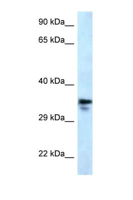 MMACHC Antibody (aa190-239)
