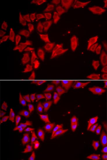SLC35A2 / UGT Antibody